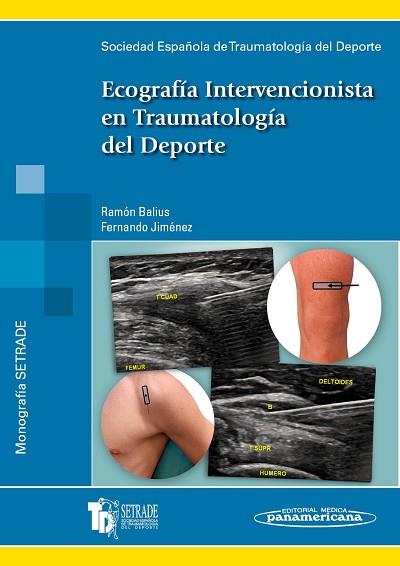 ECOGRAFÍA INTERVENCIONISTA EN TRAUMATOLOGÍA DEL DEPORTE | 9788498353617 | SETRADE SOCIEDAD ESPAÑOLA DE TRAUMATOLOGÍA DEL DEPORTE | Llibres Parcir | Librería Parcir | Librería online de Manresa | Comprar libros en catalán y castellano online