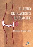 EL LIBRO DE LA ARTRITIS REUMATOIDE | 9788479785819 | ALVAREZ LARIO BONIFACIO | Llibres Parcir | Librería Parcir | Librería online de Manresa | Comprar libros en catalán y castellano online