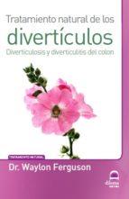 TRATAMIENTO NATURAL DE LOS DIVERTÍCULOS | 9788498273540 | FERGUSON, DR. WAYLON | Llibres Parcir | Librería Parcir | Librería online de Manresa | Comprar libros en catalán y castellano online