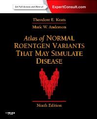 ATLAS OF NORMAL ROENTGEN VARIANTS THAT MAY SIMULATE DISEASE | 9780323073554 | KEATS, THEODORE E. | Llibres Parcir | Librería Parcir | Librería online de Manresa | Comprar libros en catalán y castellano online