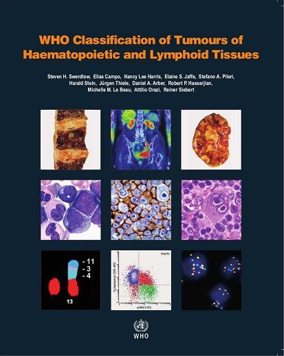 WHO CLASSIFICATION OF TUMOURS OF HAEMATOPOIETIC AND LYMPHOID TISSUES: VOL. 2.4ª | 9789283244943 | SWERDLOW,SH/CAMPO,E HARRIS/JAFFE, ES/PILERI SA/THIELE,J. | Llibres Parcir | Llibreria Parcir | Llibreria online de Manresa | Comprar llibres en català i castellà online