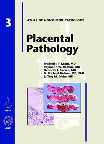 AFIP ATLAS OF NONTUMOR PATHOLOGY PLACENTAL PATHOLOGY VOL3 | 9781881041894 | Llibres Parcir | Librería Parcir | Librería online de Manresa | Comprar libros en catalán y castellano online