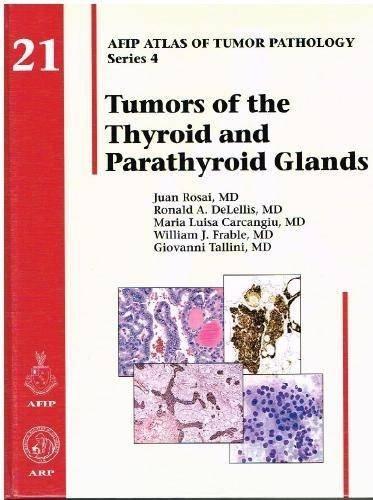 TUMORS OF THE THYROID AND PARATHYROID GLANDS. AFIP ATLAS OF TUMOR PATHOLOGY SERI | 9781933477329 | ROSAI, J. - DELELLIS, R. - CARCANGIU, M.L. - FRABLE, W. - TALLINI, G. | Llibres Parcir | Llibreria Parcir | Llibreria online de Manresa | Comprar llibres en català i castellà online